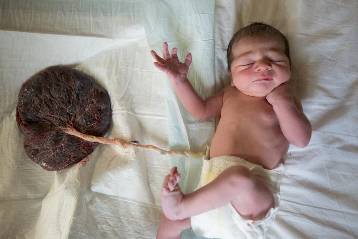 nico-fotografia-reportage-nascita-placenta-neonato